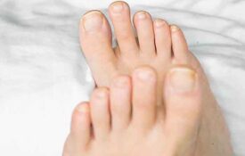 How does nail envy form?